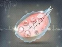 在江西省妇幼保健院辅助生殖中心做试管婴儿要多少钱？