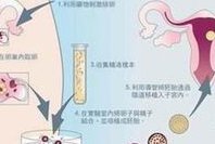 2026年北医三院做试管婴儿多少钱？附费用明细！