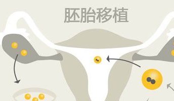 试管取-卵后出现腹痛怎么办？专家告诉你应对方法！